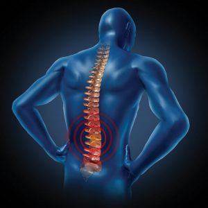 How to identify back pain.